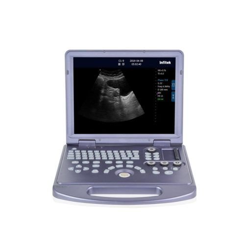 Ultrasound Machine, Black &amp; White, US-H360